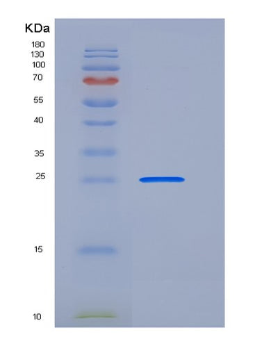 SDS-PAGE analysis of Human NTMT1 (N-Terminal Xaa-Pro-Lys N-Methyltransferase 1) - Recombinant Protein, CAT# BLT-06328P, showing >95% purity under 15% SDS-PAGE (Reduced)Human NTMT1 (N-Terminal Xaa-Pro-Lys N-Methyltransferase 1) - Recombinant Protein