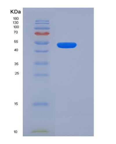 SDS-PAGE analysis of Human CTSC (Dipeptidyl Peptidase 1) - Recombinant Protein, CAT# BLT-06334P, showing >95% purity under 15% SDS-PAGE (Reduced)Human CTSC (Dipeptidyl Peptidase 1) - Recombinant Protein