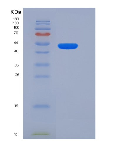 SDS-PAGE analysis of Human CTSC (Dipeptidyl Peptidase 1) - Recombinant Protein, CATHuman CTSC (Dipeptidyl Peptidase 1) - Recombinant Protein