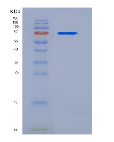 SDS-PAGE analysis of Mouse Coagulation Factor II / FII / F2 - Recombinant Protein, CAT# BLT-06341P, showing >90% purity under 15% SDS-PAGE (Reduced)Mouse Coagulation Factor II / FII / F2 - Recombinant Protein