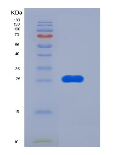 SDS-PAGE analysis of Human FOLR2 (Folate Receptor Beta) - Recombinant Protein, CAT# BLT-06343P, showing >95% purity under 15% SDS-PAGE (Reduced)Human FOLR2 (Folate Receptor Beta) - Recombinant Protein