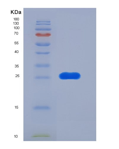 SDS-PAGE analysis of Human FOLR2 (Folate Receptor Beta) - Recombinant Protein, CATHuman FOLR2 (Folate Receptor Beta) - Recombinant Protein