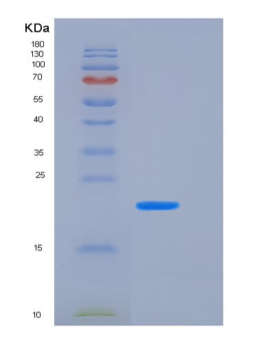 SDS-PAGE analysis of Human TNFRSF4 (Tumor Necrosis Factor Receptor Superfamily Member 4) - Recombinant Protein, CATHuman TNFRSF4 (Tumor Necrosis Factor Receptor Superfamily Member 4) - Recombinant Protein