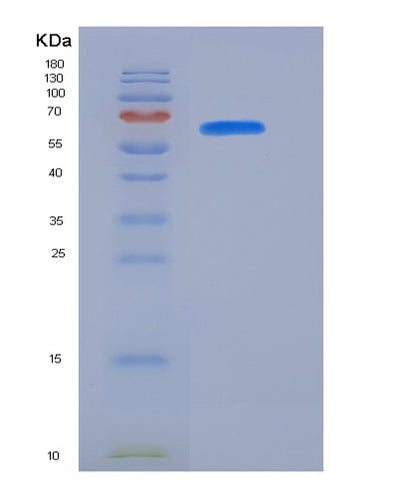 SDS-PAGE analysis of Mouse Pecam1 (Platelet Endothelial Cell Adhesion Molecule) - Recombinant Protein, CAT# BLT-06349P, showing >95% purity under 15% SDS-PAGE (Reduced)Mouse Pecam1 (Platelet Endothelial Cell Adhesion Molecule) - Recombinant Protein