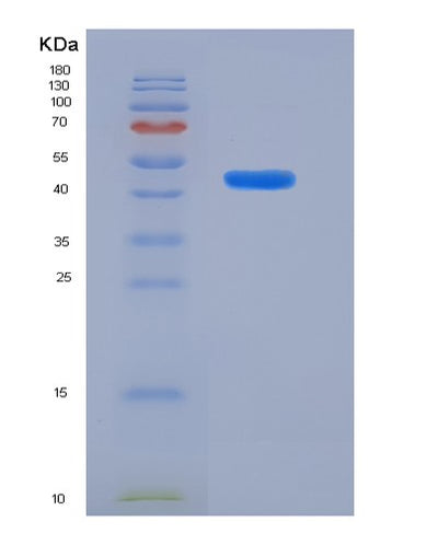 SDS-PAGE analysis of Human TNFRSF9 (Tumor Necrosis Factor Receptor Superfamily Member 9) - Recombinant Protein, CAT# BLT-06351P, showing >85% purity under 15% SDS-PAGE (Reduced)Human TNFRSF9 (Tumor Necrosis Factor Receptor Superfamily Member 9) - Recombinant Protein