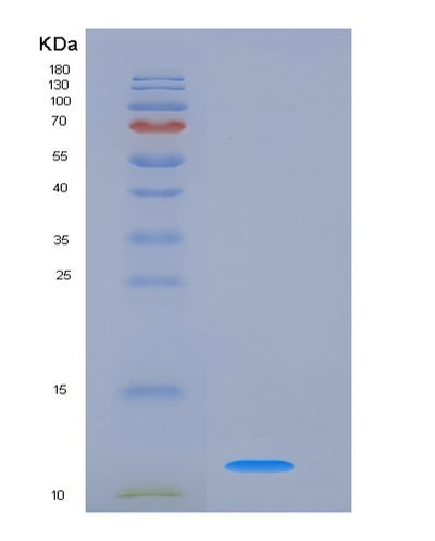 SDS-PAGE analysis of Human CSTA (Cystatin-A) - Recombinant Protein, CAT# BLT-06353P, showing >90% purity under 15% SDS-PAGE (Reduced)Human CSTA (Cystatin-A) - Recombinant Protein