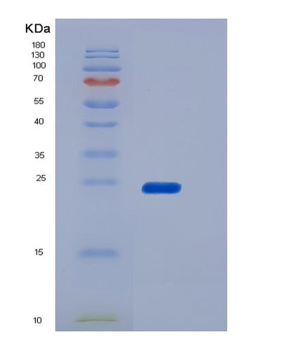 SDS-PAGE analysis of Mouse Fcgr4 (Low Affinity Immunoglobulin Gamma Fc Region Receptor Iii-A) - Recombinant Protein, CAT# BLT-06354P, showing >90% purity under 15% SDS-PAGE (Reduced)Mouse Fcgr4 (Low Affinity Immunoglobulin Gamma Fc Region Receptor Iii-A) - Recombinant Protein