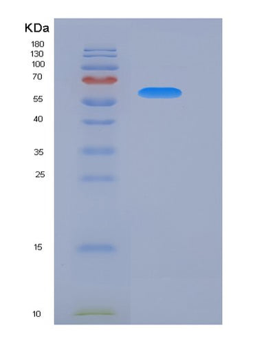 SDS-PAGE analysis of Mouse Ecm1 (Extracellular Matrix Protein 1) - Recombinant Protein, CAT# BLT-06355P, showing >95% purity under 15% SDS-PAGE (Reduced)Mouse Ecm1 (Extracellular Matrix Protein 1) - Recombinant Protein