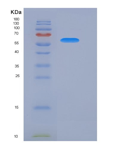 SDS-PAGE analysis of Mouse Ecm1 (Extracellular Matrix Protein 1) - Recombinant Protein, CATMouse Ecm1 (Extracellular Matrix Protein 1) - Recombinant Protein