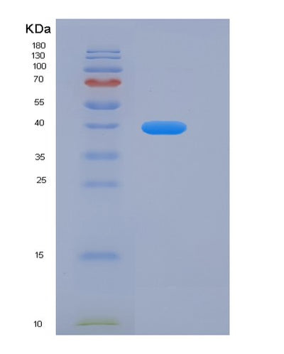 SDS-PAGE analysis of Human LAMP1 (Lysosome-Associated Membrane Glycoprotein 1) - Recombinant Protein, CAT# BLT-06356P, showing >90% purity under 15% SDS-PAGE (Reduced)Human LAMP1 (Lysosome-Associated Membrane Glycoprotein 1) - Recombinant Protein