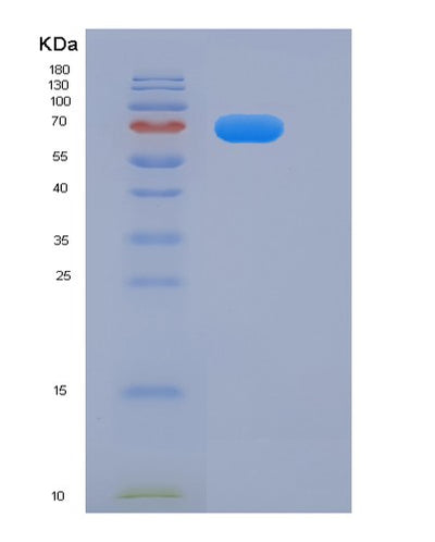 SDS-PAGE analysis of Mouse Egfr (Epidermal Growth Factor Receptor) - Recombinant Protein, CAT# BLT-06357P, showing >85% purity under 15% SDS-PAGE (Reduced)Mouse Egfr (Epidermal Growth Factor Receptor) - Recombinant Protein
