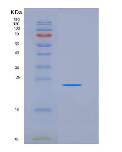 SDS-PAGE analysis of Mouse Fcgr3 (Low Affinity Immunoglobulin Gamma Fc Region Receptor Iii) - Recombinant Protein, CAT# BLT-06358P, showing >95% purity under 15% SDS-PAGE (Reduced)Mouse Fcgr3 (Low Affinity Immunoglobulin Gamma Fc Region Receptor Iii) - Recombinant Protein