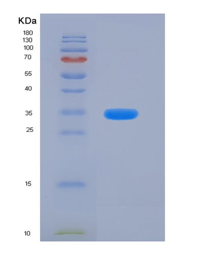 SDS-PAGE analysis of Human CADM3 (Cell Adhesion Molecule 3) - Recombinant Protein, CAT# BLT-06361P, showing >95% purity under 15% SDS-PAGE (Reduced)Human CADM3 (Cell Adhesion Molecule 3) - Recombinant Protein