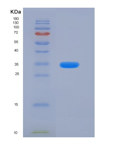SDS-PAGE analysis of Human CADM3 (Cell Adhesion Molecule 3) - Recombinant Protein, CATHuman CADM3 (Cell Adhesion Molecule 3) - Recombinant Protein