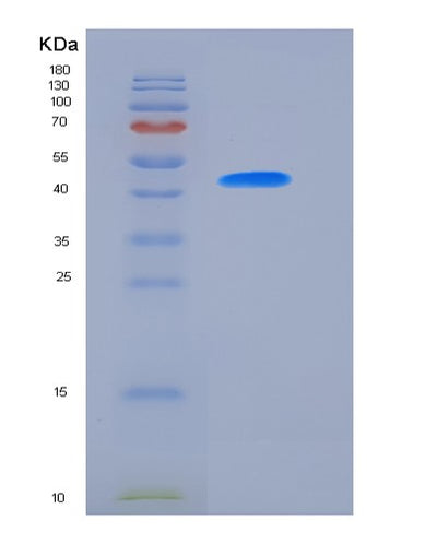 SDS-PAGE analysis of Human FZD5 (Frizzled-5) - Recombinant Protein, CAT# BLT-06362P, showing >90% purity under 15% SDS-PAGE (Reduced)Human FZD5 (Frizzled-5) - Recombinant Protein