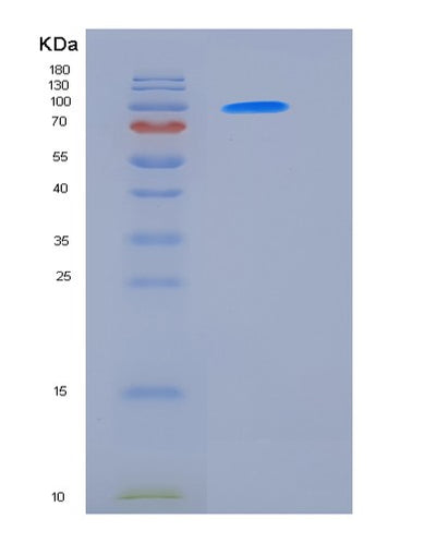 SDS-PAGE analysis of Human KDR (Vascular Endothelial Growth Factor Receptor 2) - Recombinant Protein, CAT# BLT-06363P, showing >85% purity under 15% SDS-PAGE (Reduced)Human KDR (Vascular Endothelial Growth Factor Receptor 2) - Recombinant Protein