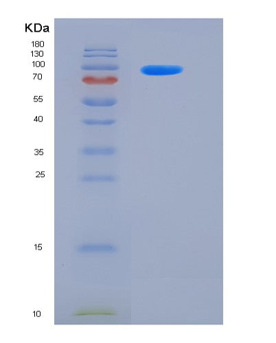 SDS-PAGE analysis of Mouse Egfr (Epidermal Growth Factor Receptor) - Recombinant Protein, CATMouse Egfr (Epidermal Growth Factor Receptor) - Recombinant Protein