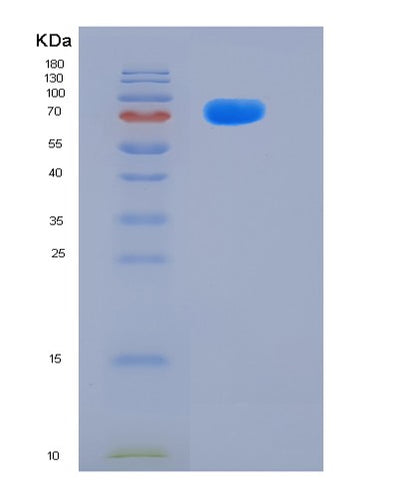 SDS-PAGE analysis of Human MME (Neprilysin) - Recombinant Protein, CAT# BLT-06365P, showing >90% purity under 15% SDS-PAGE (Reduced)Human MME (Neprilysin) - Recombinant Protein