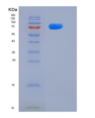 SDS-PAGE analysis of Human MME (Neprilysin) - Recombinant Protein, CATHuman MME (Neprilysin) - Recombinant Protein