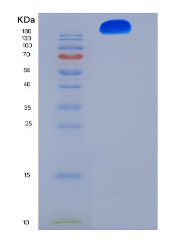 SDS-PAGE analysis of Human ITGA5 (Integrin Alpha-5) - Recombinant Protein, CAT# BLT-08432P showing >95% purity under 15% SDS-PAGE (Reduced)Human ITGA5 (Integrin Alpha-5) - Recombinant Protein