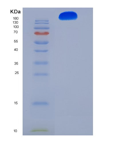 SDS-PAGE analysis of Human ITGA5 (Integrin Alpha-5) - Recombinant Protein, CATHuman ITGA5 (Integrin Alpha-5) - Recombinant Protein