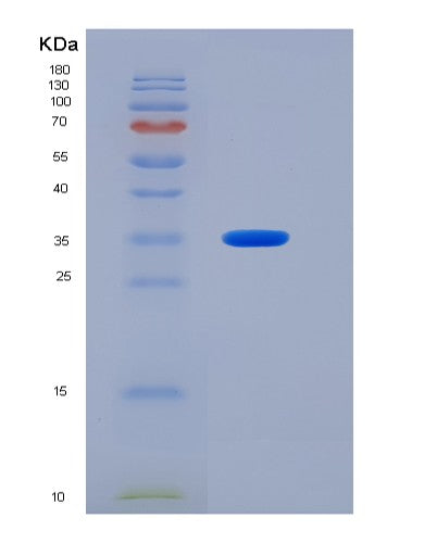 SDS-PAGE analysis of Mouse Nectin2 (Nectin-2) - Recombinant Protein, CATMouse Nectin2 (Nectin-2) - Recombinant Protein