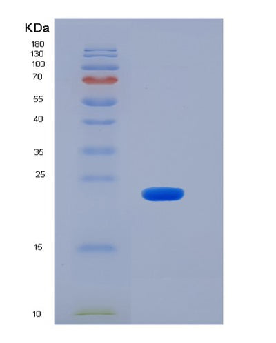 SDS-PAGE analysis of Human CD48 (Cd48 Antigen) - Recombinant Protein, CAT# BLT-06373P, showing >90% purity under 15% SDS-PAGE (Reduced)Human CD48 (Cd48 Antigen) - Recombinant Protein