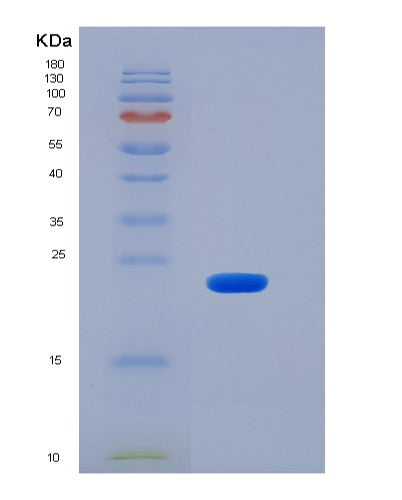 SDS-PAGE analysis of Human CD48 (Cd48 Antigen) - Recombinant Protein, CATHuman CD48 (Cd48 Antigen) - Recombinant Protein