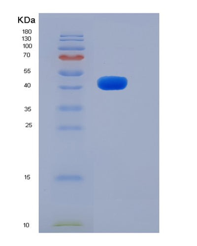 SDS-PAGE analysis of Mouse Robo4 (Roundabout Homolog 4) - Recombinant Protein, CAT# BLT-06374P, showing >85% purity under 15% SDS-PAGE (Reduced)Mouse Robo4 (Roundabout Homolog 4) - Recombinant Protein