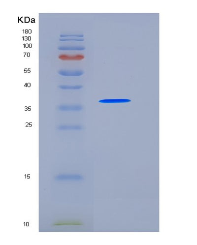 SDS-PAGE analysis of Human CD5L (Cd5 Antigen-Like) - Recombinant Protein, CAT# BLT-06375P, showing >95% purity under 15% SDS-PAGE (Reduced)Human CD5L (Cd5 Antigen-Like) - Recombinant Protein