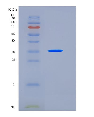 SDS-PAGE analysis of Human NECTIN2 (Nectin-2) - Recombinant Protein, CAT# BLT-06376P, showing >90% purity under 15% SDS-PAGE (Reduced)Human NECTIN2 (Nectin-2) - Recombinant Protein