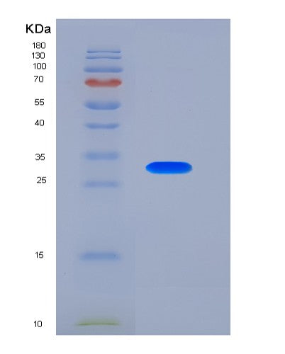 SDS-PAGE analysis of Mouse Tnfrsf13c (Tumor Necrosis Factor Receptor Superfamily Member 13C) - Recombinant Protein, CATMouse Tnfrsf13c (Tumor Necrosis Factor Receptor Superfamily Member 13C) - Recombinant Protein