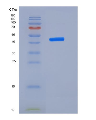 SDS-PAGE analysis of Human RTN4R (Reticulon-4 Receptor) - Recombinant Protein, CAT# BLT-06380P, showing >85% purity under 15% SDS-PAGE (Reduced)Human RTN4R (Reticulon-4 Receptor) - Recombinant Protein