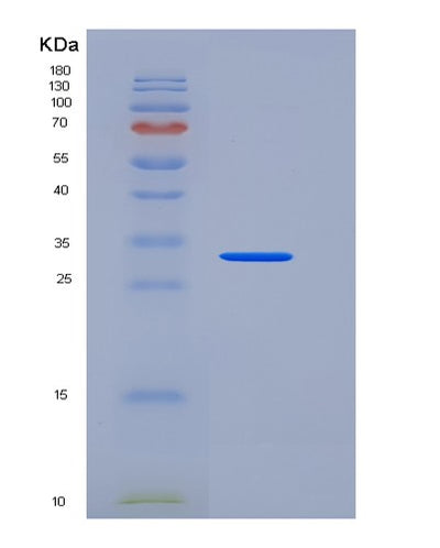SDS-PAGE analysis of Mouse OBCAM / OPCML - Recombinant Protein, CAT# BLT-06382P, showing >90% purity under 15% SDS-PAGE (Reduced)Mouse OBCAM / OPCML - Recombinant Protein