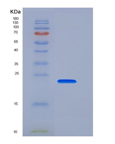 SDS-PAGE analysis of Human PRDX1 (Peroxiredoxin-1) - Recombinant Protein, CAT# BLT-06384P, showing >95% purity under 15% SDS-PAGE (Reduced)Human PRDX1 (Peroxiredoxin-1) - Recombinant Protein