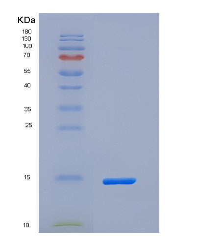 SDS-PAGE analysis of Human SECTM1 (Secreted And Transmembrane Protein 1) - Recombinant Protein, CATHuman SECTM1 (Secreted And Transmembrane Protein 1) - Recombinant Protein