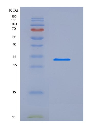 SDS-PAGE analysis of Human CD68 (Macrosialin) - Recombinant Protein, CATHuman CD68 (Macrosialin) - Recombinant Protein