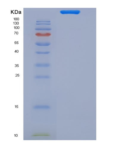 SDS-PAGE analysis of Mouse Btla (B- And T-Lymphocyte Attenuator) - Recombinant Protein, CAT# BLT-06389P, showing >85% purity under 15% SDS-PAGE (Reduced)Mouse Btla (B- And T-Lymphocyte Attenuator) - Recombinant Protein