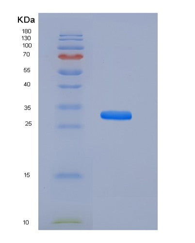 SDS-PAGE analysis of Human ASGR1 (Asialoglycoprotein Receptor 1) - Recombinant Protein, CATHuman ASGR1 (Asialoglycoprotein Receptor 1) - Recombinant Protein