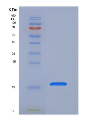SDS-PAGE analysis of Human FZD4 (Frizzled-4) - Recombinant Protein, CAT# BLT-06392P, showing >95% purity under 15% SDS-PAGE (Reduced)Human FZD4 (Frizzled-4) - Recombinant Protein