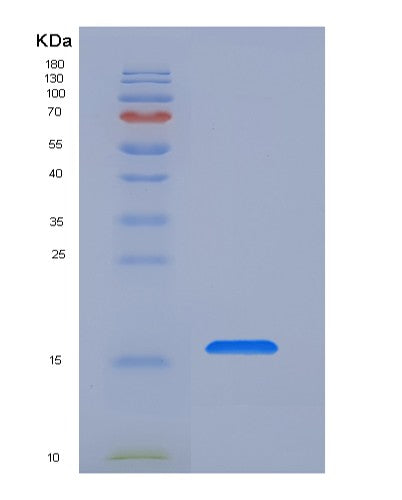 SDS-PAGE analysis of Human FZD4 (Frizzled-4) - Recombinant Protein, CATHuman FZD4 (Frizzled-4) - Recombinant Protein