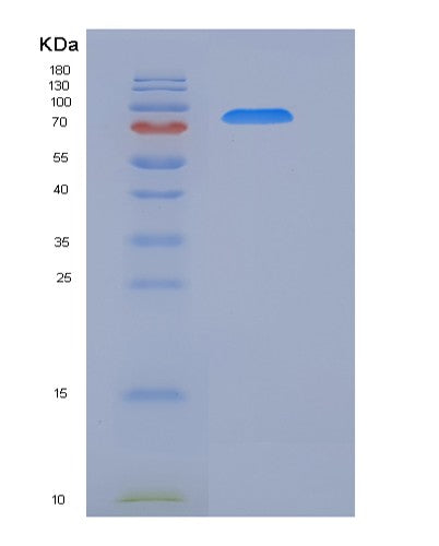 SDS-PAGE analysis of Human EPHB2 (Ephrin Type-B Receptor 2) - Recombinant Protein, CATHuman EPHB2 (Ephrin Type-B Receptor 2) - Recombinant Protein