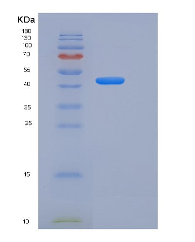 SDS-PAGE analysis of Mouse Ace2 (Angiotensin-Converting Enzyme 2) - Recombinant Protein, CATMouse Ace2 (Angiotensin-Converting Enzyme 2) - Recombinant Protein