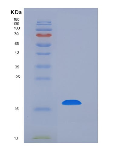 SDS-PAGE analysis of Human REG4 (Regenerating Islet-Derived Protein 4) - Recombinant Protein, CAT# BLT-06404P, showing >90% purity under 15% SDS-PAGE (Reduced)Human REG4 (Regenerating Islet-Derived Protein 4) - Recombinant Protein