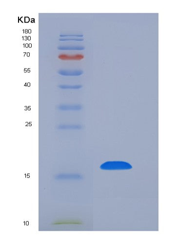 SDS-PAGE analysis of Human REG4 (Regenerating Islet-Derived Protein 4) - Recombinant Protein, CATHuman REG4 (Regenerating Islet-Derived Protein 4) - Recombinant Protein