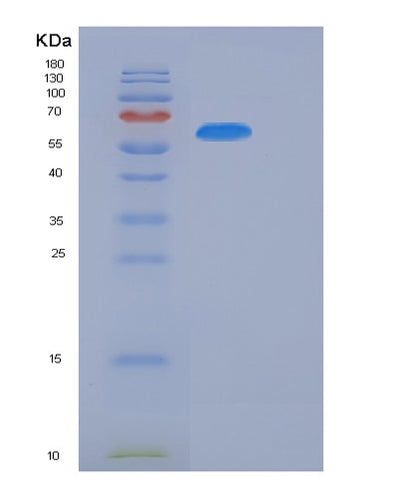 SDS-PAGE analysis of Human FLT3 (Receptor-Type Tyrosine-Protein Kinase Flt3) - Recombinant Protein, CAT# BLT-06409P, showing >95% purity under 15% SDS-PAGE (Reduced)Human FLT3 (Receptor-Type Tyrosine-Protein Kinase Flt3) - Recombinant Protein