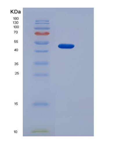 SDS-PAGE analysis of Human CD36 (Platelet Glycoprotein 4) - Recombinant Protein, CAT# BLT-06413P, showing >85% purity under 15% SDS-PAGE (Reduced)Human CD36 (Platelet Glycoprotein 4) - Recombinant Protein