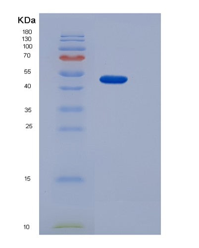SDS-PAGE analysis of Human CD36 (Platelet Glycoprotein 4) - Recombinant Protein, CATHuman CD36 (Platelet Glycoprotein 4) - Recombinant Protein
