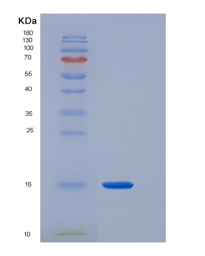 SDS-PAGE analysis of Human CST3 (Cystatin-C) - Recombinant Protein, CATHuman CST3 (Cystatin-C) - Recombinant Protein