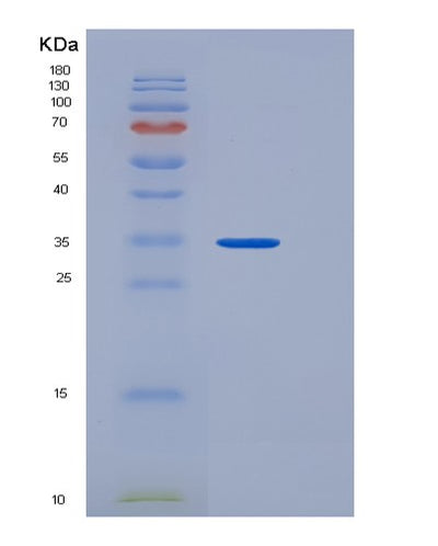 SDS-PAGE analysis of Mouse Fcer2 (Low Affinity Immunoglobulin Epsilon Fc Receptor) - Recombinant Protein, CAT# BLT-06421P, showing >85% purity under 15% SDS-PAGE (Reduced)Mouse Fcer2 (Low Affinity Immunoglobulin Epsilon Fc Receptor) - Recombinant Protein